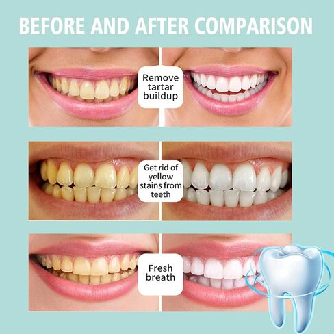 2PCS Foam Toothpaste,Stain Removal Toothpaste for Sensitive Teeth, Ultra-fine Mousse Foam, Deeply Cleans Gums, Removes Stains, Refreshes Breath (2) in Kuwait