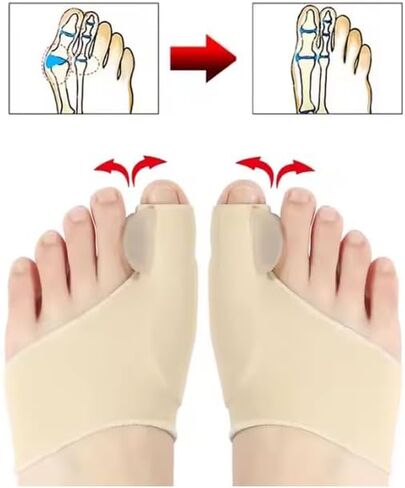 2-in-1 Foot Care Kit – Toe Correctors for Women and Men & Metatarsal Pads – Ball of Foot Cushions for Heels, Toe Separators for Alignment, Blister Prevention, Forefoot Pain Relief Bundle in Saudi Arabia