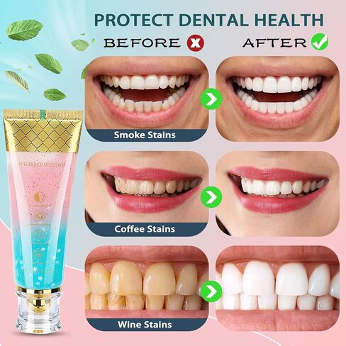 Niacinamide Whitening Toothpaste,Stain-Removing, Fluoride-Free, with Natural Cherry Blossom & Mint Flavor. Helps Reduce Stains, Freshens Breath, and Improve Gum Health in Saudi Arabia
