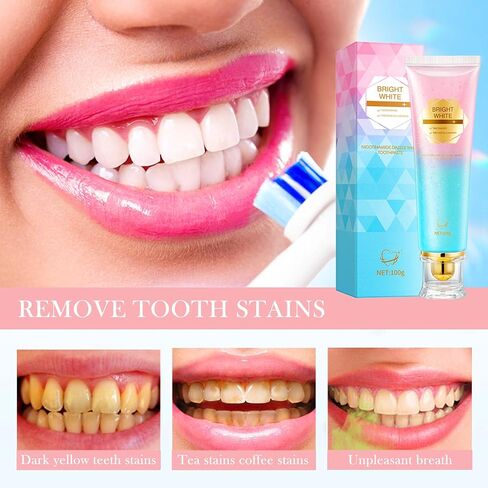 Niacinamide Whitening Toothpaste, Niacinamide Dazzling Toothpastes White, Niacinamide Toothpaste, Teeth Whitening, Toothpastes, Remove Tooth Stains, Gentle Mint, Fresh Breath, Deep Cleaning Care(1pcs) in Saudi Arabia