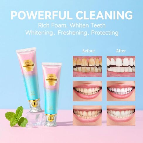 Niacinamide Whitening Toothpaste, Niacinamide Dazzling Toothpastes White, Niacinamide Toothpaste, Teeth Whitening, Toothpastes, Remove Tooth Stains, Gentle Mint, Fresh Breath, Deep Cleaning Care(1pcs) in Saudi Arabia