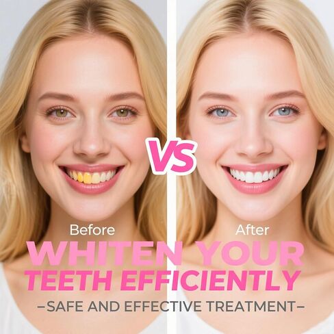 Niacinamide Whitening Toothpaste, Niacinamide Dazzling Toothpastes White, Niacinamide Toothpaste, Teeth Whitening, Toothpastes, Remove Tooth Stains, Gentle Mint, Fresh Breath, Deep Cleaning Care(1pcs) in Saudi Arabia