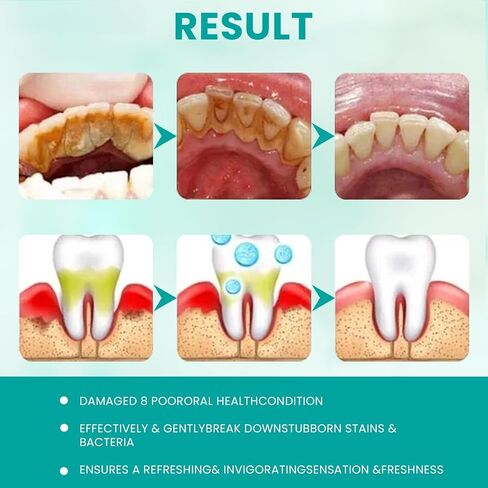 2pcs SP6 Probiotic Whitening Spatte ، SP 6 معجون أسنان ، SP-6 تبييض فائقة ، أنفاس طازجة in Kuwait