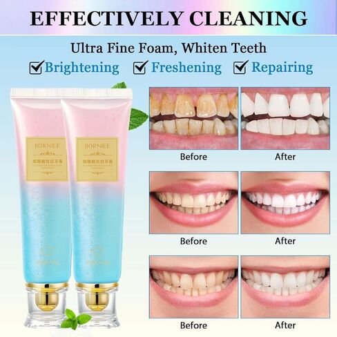 Niacinamide Whitening Toothpaste,Remove Tooth Stains,Improves Gum Health Fresh Breath 3.53 oz/ 100g (1) in Saudi Arabia