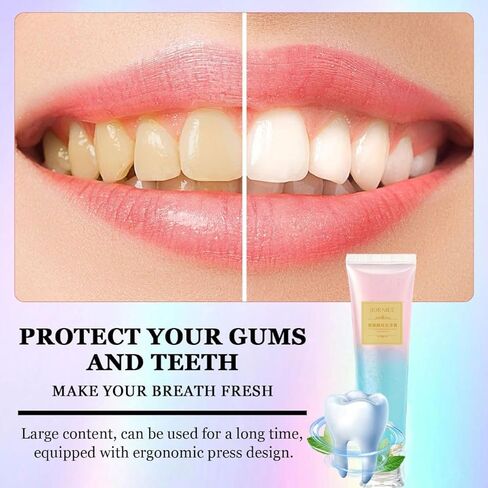 Niacinamide Whitening Toothpaste,Remove Tooth Stains,Improves Gum Health Fresh Breath 3.53 oz/ 100g (1) in Saudi Arabia