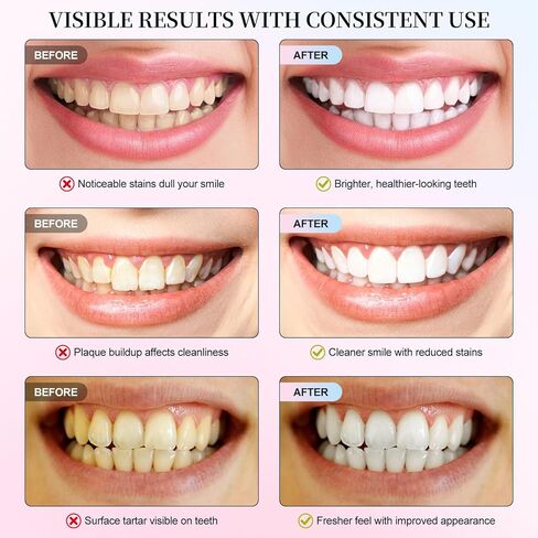 معجون أسنان تبييض النياسيناميد 2 PCS ، معجون أسنان مكثف بالنياسيناميد ، وتنفس الأسنان وتنفسه الطازج ، معجون الأسنان اللطيف العميق ، تعزيز صحة اللثة ، نكهة النعناع والخوخ 3.53 أوقية in Kuwait