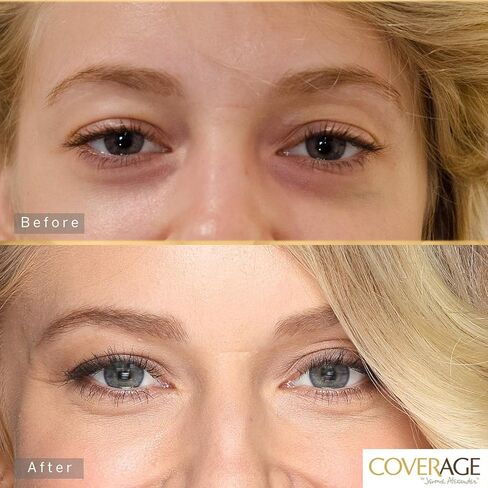 CoverAge Eye Concealer by Jerome Alexander - 5-in-1 Concealer Stick and Eye Roller Ball, Under Eye Circle Concealer, Corrector, Moisturizer, & Tightener for Anti-Aging in Saudi Arabia