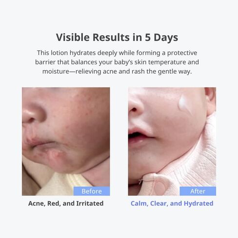 Cha & Mom Corean Baby Baby العناية بالبشرة - غسول الرطوبة في Phyto Seline الطبيعية ، 8.46 أوقية in Kuwait