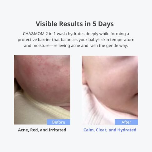 Cha & Mom وجهاً لوجه من العناية بالبشرة الكورية-Hypoallergenic ، قائم على النباتات ، وغسل الشعر الطبيعي ، 10.58 أوقية in Kuwait