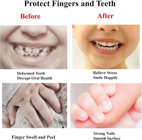 HS&ROXIN Thumb Sucking Gloves 5 Fingers Sucking Guard Stop Thumb Sucking and Nail Biting for Kids Ages 6 Months to 8 Years (S) in Saudi Arabia