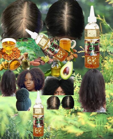 Organic Hair Solution- Hair Growth Gift Set For Stronger, Thicker Longer Hair-for Split Ends and Dry Scalp With Jojoba seed- Peppermint, Mango butter,Mustard-Castor-Tea Tree-Argan-Avocado-(pack of 6) in Saudi Arabia
