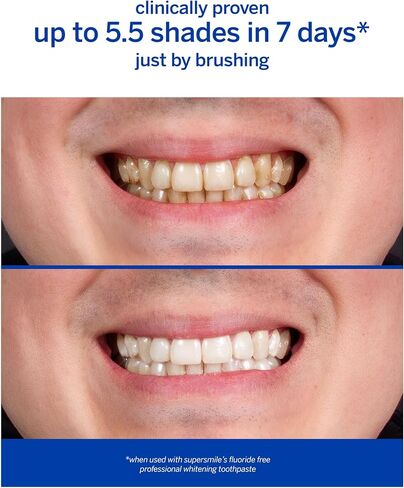 Supersmile Professional Teeth Whitening Toothpaste - Fluoride Free 4.2 Oz in Saudi Arabia