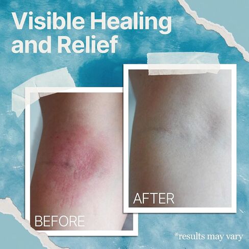 Natural Soothing Cream - Sea Moss Colloidal Oats - for Eczema Psoriasis Prone Skin - Minerals from The Sea - for Sensitive Skin - Hydrating Eczema Cream for Dry Skin (4 Oz) in Saudi Arabia