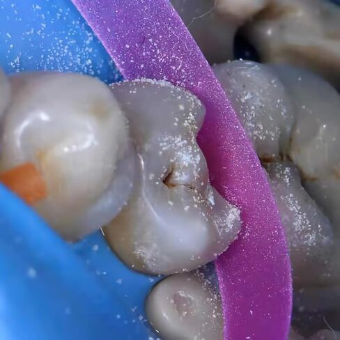 2Box Dental Polishing Strips, 4mm Tooth Interdental Resin Surface Sanding, Teeth Whitening Oral Care, Dental File for Teeth, Dentist Tools in Kuwait