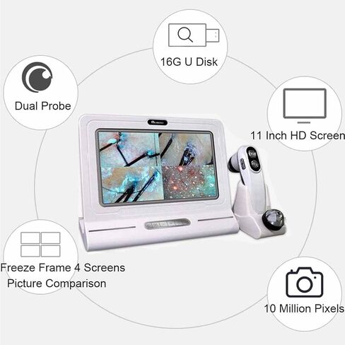 11 "مجهر كاشف فروة الرأس HD - 50x/200x ، محلل الشعر والجلد من أجل اختبار فروة الرأس متعدد الوظائف ، أداة تحليل ذكية لحلول الشعر الصحي in Kuwait