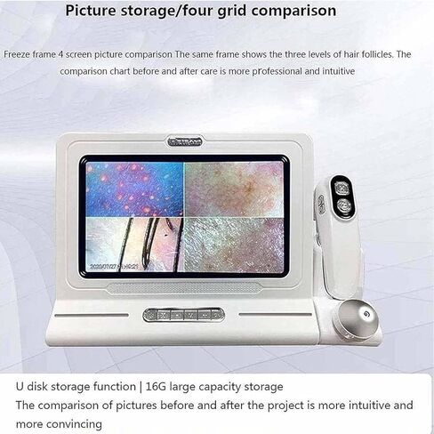11 "مجهر كاشف فروة الرأس HD - 50x/200x ، محلل الشعر والجلد من أجل اختبار فروة الرأس متعدد الوظائف ، أداة تحليل ذكية لحلول الشعر الصحي in Kuwait
