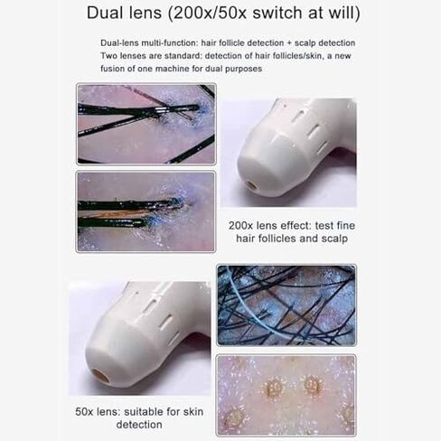 محلل الجلد والشعر عالي الدقة - 11 "مجهر رقمي LCD لاختبار جريب فروة الرأس والشعر ، قابلة للشحن ، مثالية لاستخدام المنزل والصالون ، الفضة in Kuwait