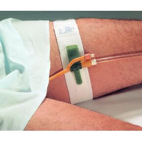 Dale Medical 316 Hold-n-Place Foley Catheter Tube Holder Leg Band (Pack of 10)