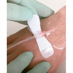 Medline DYND7600S Tube Securement Devices (Pack of 100)