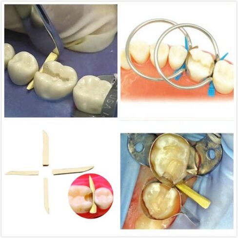 Wooden Wedges Dental, Teeth Interproximal Wedges Disposable Fixing Materials for Dental Restoration, Impregnated with Hemostatic Composition Dental Set 200pcs in Kuwait
