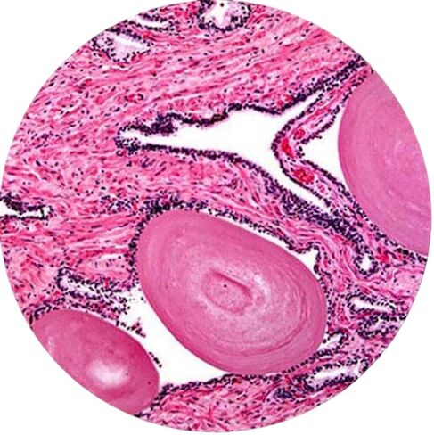 AmScope B120C-WM Siedentopf Binocular Compound Microscope, 40X-2500X Magnification, Brightfield, LED Illumination, Abbe Condenser, Double-Layer Mechanical Stage, Includes Book in Kuwait