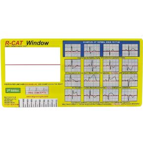R-CAT EKG Window 2nd Edition