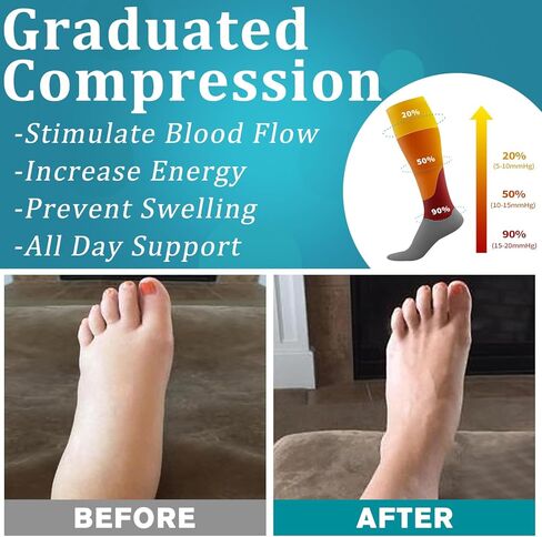 مجموعة من 6 جوارب ضغط نحاسية من بلومابل للنساء والرجال، أفضل دعم للدورة الدموية والجري والتمريض والرياضة in Kuwait