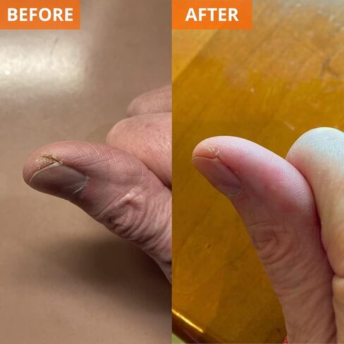 أنبوب كريمة البشرة المرطبة Yu -be - كريمة مرطبة ليلا ونهارا | تخفيف مرطب للجلد الجاف | آمن للوجه والجسم | يخفف اليدين والقدمين | نباتي | Paraben Free (1 Fl Oz/28ml) in Saudi Arabia