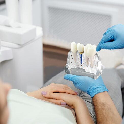 Dental Implant Model for Patient Education, 4 Times Dental Implant, Crown and Bridge Model for Presentation-Pink in Saudi Arabia