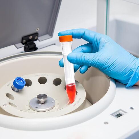 أنابيب الطرد المركزي الدقيقة 2 مل 1000 قطعة، أنابيب الطرد المركزي مع غطاء مرفق، حاوية قوارير زجاجات صغيرة مستديرة شفافة للطرد المركزي للمختبر، أنابيب بلاستيكية للمختبر، [2 مل، عبوتين كيس، 1000 قطعة] in Kuwait