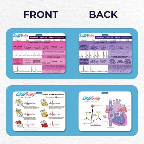 EKG Buddy's 5 Card Interpretation Badge Kit- Doubled Sided Nurse ECG Cards and Heart Phlebotomy Badge Reel for Rhythm Cheat Sheet, ACLS Medical Cardiac Reference and Nursing Student Gift Accessories in Saudi Arabia