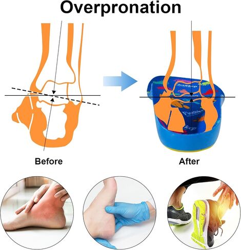 FiotSkep Kids Orthotics نعال داعمة للقوس العالي، التهاب اللفافة الأخمصية، أقدام مسطحة، حشوات من إسفنج البولي يوريثان تخفف آلام قدم الأطفال، وسادة جل لألم الكعب (3-7 أشهر للأطفال الصغار) in Saudi Arabia