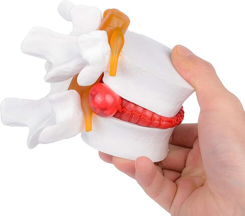 Cervical Vertebra Model, Showing Cervical Vertebra, Cervical Nerve, Vertebral Artery and Occipital Plate, Life-Size Cervical Vertebra Model, Medical Model for Teaching Research and Learning in Saudi Arabia