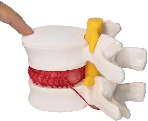 Human Herniated Disc Model, Anatomical Herniated Lumbar Vertebrae Disc Prolapse Model for Medical Teaching Learning, Kids Learning Education Display Toolning, Kids Learning Education Display Tool in Kuwait