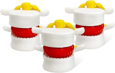Human Herniated Disc Model, Anatomical Herniated Lumbar Vertebrae Disc Prolapse Model for Medical Teaching Learning, Kids Learning Education Display Toolning, Kids Learning Education Display Tool in Kuwait