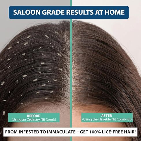 Professional 6-in-1 Lice, Nit & Dandruff Comb Kit | For Kids, Adults, Pets | All Hair Types | Micro Spiral, Precision & 2× Double-Sided Combs | Brush, Tracker & EVA Case | in Saudi Arabia