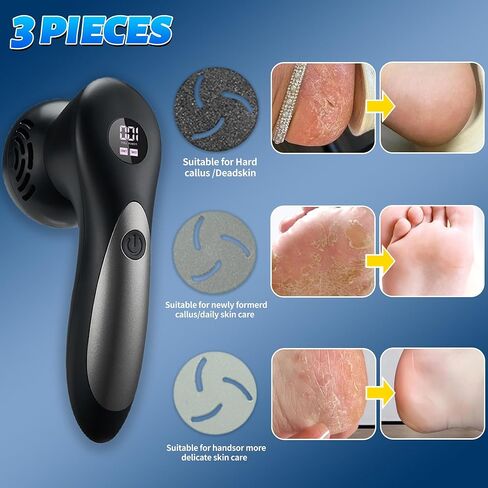 Electric Feet Foot Callus Remover Equipped with A Vacuum System Foot Scrubber 17 in 1 Professional Foot Care Tool Ipx6 Waterproof Rating for Removing Hard Cracks Dryness and Dead Skin (Black) in Kuwait