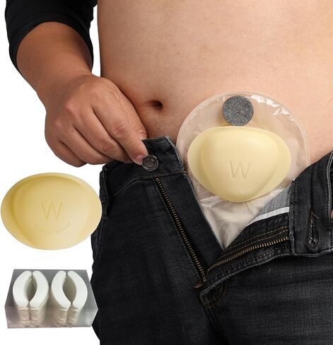حارس Stoma و 50 زوجًا من الملصقات | الحماية النهائية لحقيبة فغرك in Kuwait