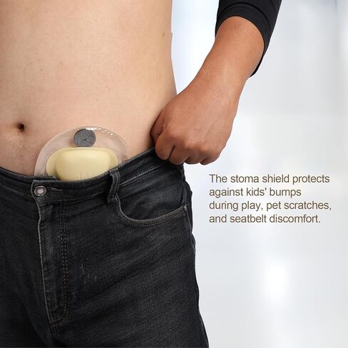 حارس Stoma و 50 زوجًا من الملصقات | الحماية النهائية لحقيبة فغرك in Kuwait