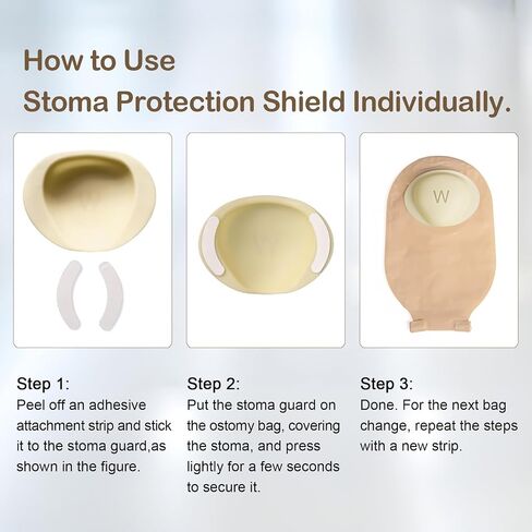 حارس Stoma و 50 زوجًا من الملصقات | الحماية النهائية لحقيبة فغرك in Kuwait