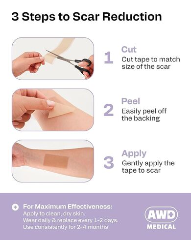 AWD Silicone Scar Sheets for Surgical Scars - Seamless Medical Grade Silicone Scar Tape for C Section, Tummy Tuck Tape - Silicone Skin Patches After Surgery Must Haves (1.6" x 60" Seamless Roll) in Kuwait