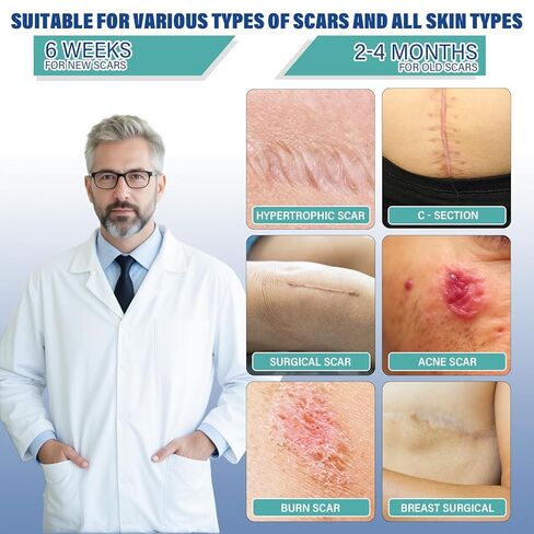 Silicone Scar Sheets,Silicone Scar Tape(1.6"x 158" Roll-4 meters),Silicone Scar Sheets for Surgical Scars,Keloid Bump Removal,Scar Tape for Surgical,C-Section,Tummy Tuck,Keloid Scars in Kuwait