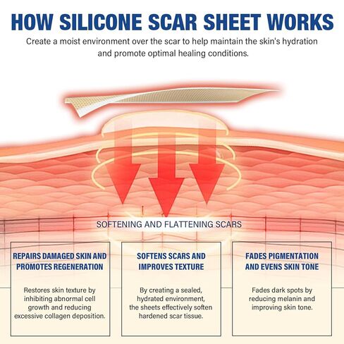 Silicone Scar Sheets,Silicone Scar Tape(1.6"x 158" Roll-4 meters),Silicone Scar Sheets for Surgical Scars,Keloid Bump Removal,Scar Tape for Surgical,C-Section,Tummy Tuck,Keloid Scars in Kuwait