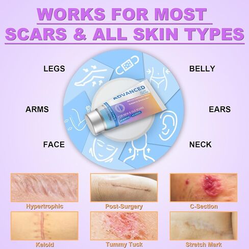 Silicone Scar Cream Scar Gel - Advanced Scar Treatment Keloid Bump Removal for Surgical Scars, C-Section, Injury, Stretch Marks, Acne, Burns, Keloids, Old & New Scars, 1.23Oz (35g) in Saudi Arabia