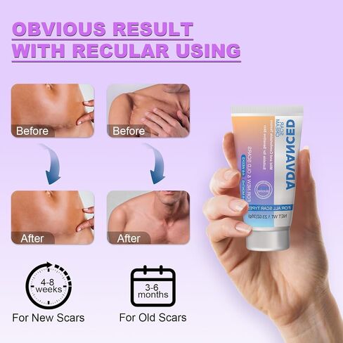 Silicone Scar Cream Scar Gel - Advanced Scar Treatment Keloid Bump Removal for Surgical Scars, C-Section, Injury, Stretch Marks, Acne, Burns, Keloids, Old & New Scars, 1.23Oz (35g) in Saudi Arabia