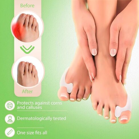 فاصل تصنيع مصحوب الرنم لأصابع القدم الكبيرة للاسترخاء والانتشار وتمتد 10pcs لدعم Hallux Valgus & Bunion- 0 ٪ BPA منصات واحدة من الحجم الحجم ، واقي لأصابع القدم المتداخلة للجنسين in Saudi Arabia