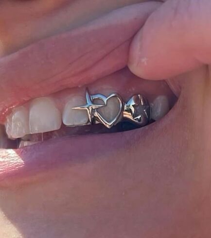 Longita Silver Teeth Grillz for Women Grills for Your Teeth in Saudi Arabia