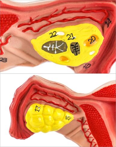 QWORK Human Female Uterus and Ovary Model, Female Genital Organ, Reproductive Organ Model, Uterine Medical Teaching Anatomical Gynecology Uterus and Ovary Model, Human Anatomy Replica in Saudi Arabia