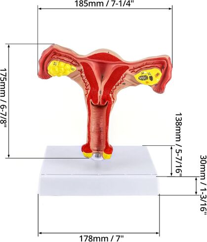 QWORK Human Female Uterus and Ovary Model, Female Genital Organ, Reproductive Organ Model, Uterine Medical Teaching Anatomical Gynecology Uterus and Ovary Model, Human Anatomy Replica in Saudi Arabia