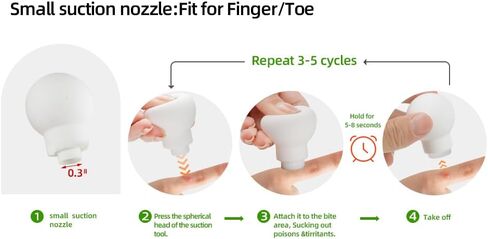 Bug Bite Suction Tool - Bug Bites and Bee/Wasp Stings, Portable Bite & Sting First Aid,Silicone,Chemical Free,Summer Essentials for Kids & Adults,White Green in Saudi Arabia